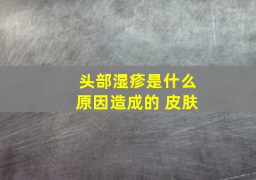 头部湿疹是什么原因造成的 皮肤